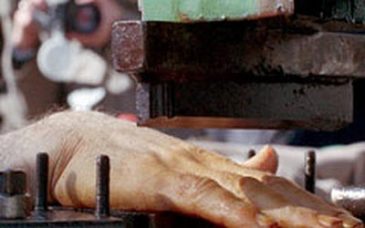 Iran-amputation-finger-gr_03_xNrP0BC.jpg.885x520_q85_box-089240230_crop_d_57qDsoA.jpg.885x520_q85_box-00884520_crop_detail_upscale Iran-amputation-finger-gr_03_xNrP0BC.jpg.885x520_q85_box-089240230_crop_d_57qDsoA.jpg.885x520_q85_box-00884520_crop_detail_upscale