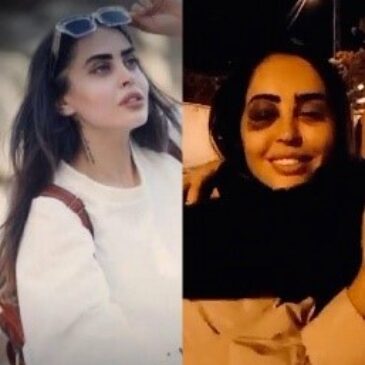 MinaYaghoubi